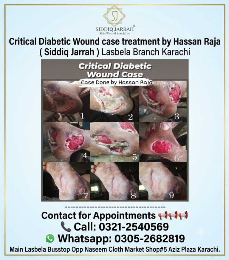 Specialized Patient Support